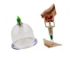 Akupunktūras Vakuuma Masāžas Bankas, 12 gab. | Vacuum Massage Bubbles Jars