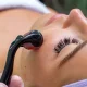 Derma Roller sejas masāžas rullītis 0.5mm, tumši violets