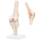 4Fizjo 1073 Ceļa locītavas anatomiskais modelis 1:1