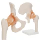 4Fizjo 1253 gūžas locītavas anatomiskais modelis ar saitēm, 1:1, balts