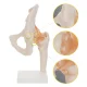 4Fizjo 1253 gūžas locītavas anatomiskais modelis ar saitēm, 1:1, balts